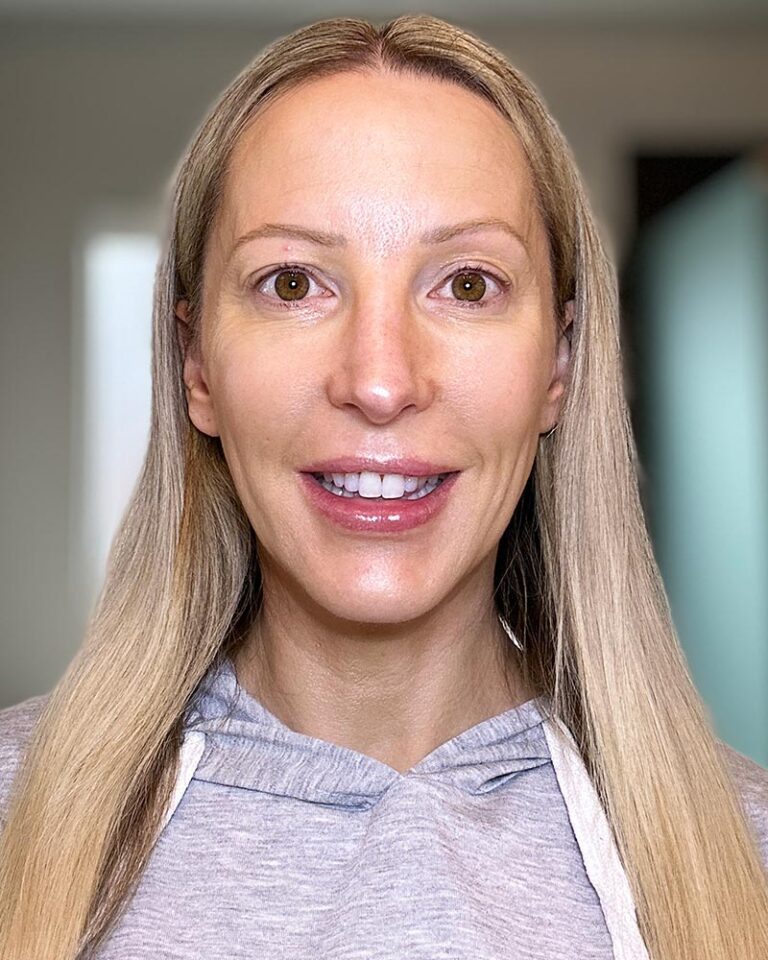 How to Fix Hooded Eyes, Droopy Eyelids & Crows Feet Naturally