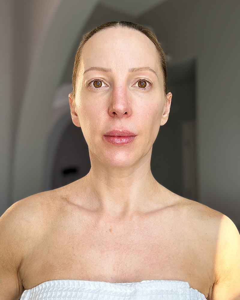 NuFace after 60 days results