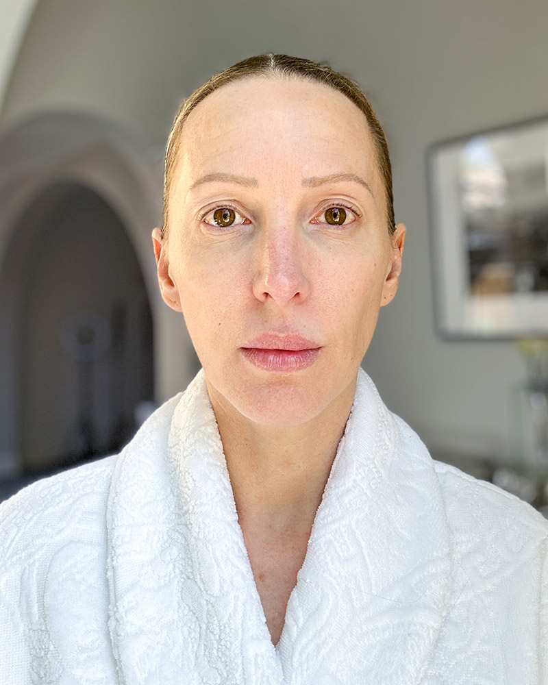 NuFACE after 1st use woman results 5 minute facelift