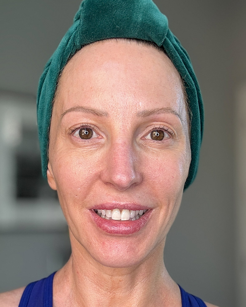 banish before after photos