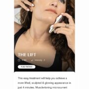 best botox alternative non surgical facelift ziip