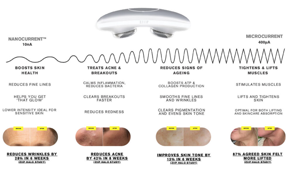 ziip halo microcurrent intensity