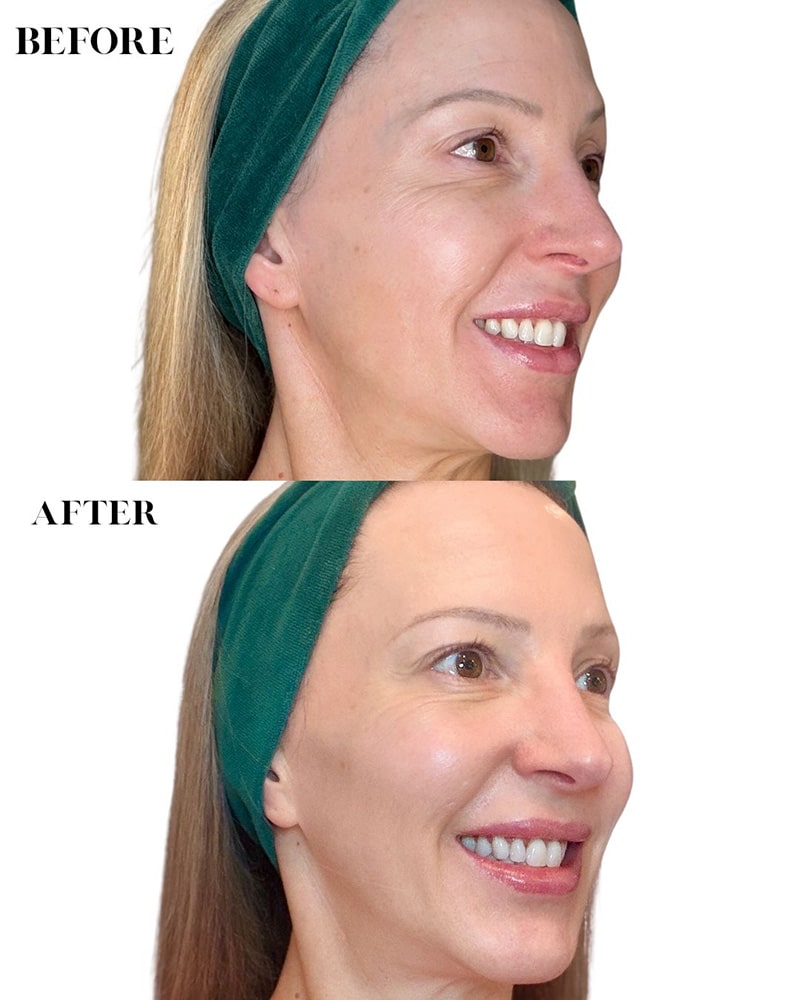 Eighth Day Skincare results before after