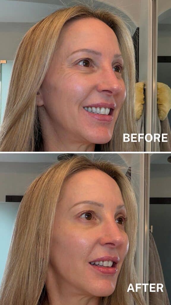 Dr. Brandt Skincare Wrinkle Release Serum Before After Results