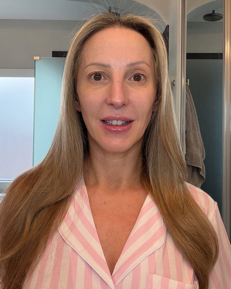 Dr. Brandt Wrinkle Release Serum Before After