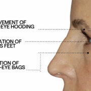 Dr Diamond's Metacine Contour Collection EyeLift