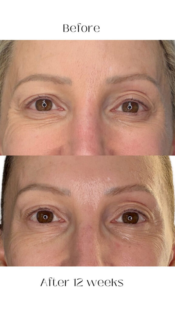 Dr Diamond's Contour Collection Eyelift review does it work results