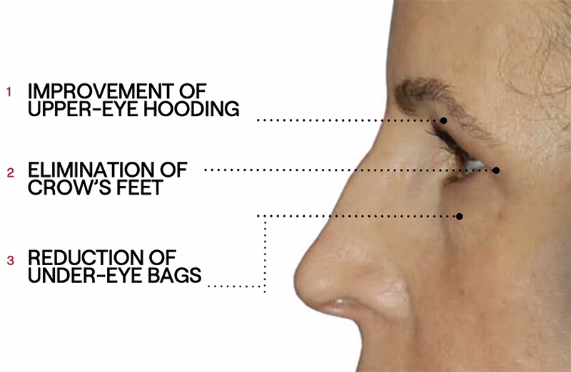 Dr Diamonds Contour Eyelift benefits