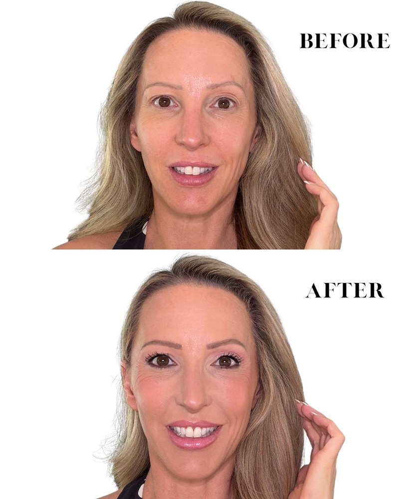 Haus Labs Triclone Skin Tech Foundation results mature white woman blonde hair