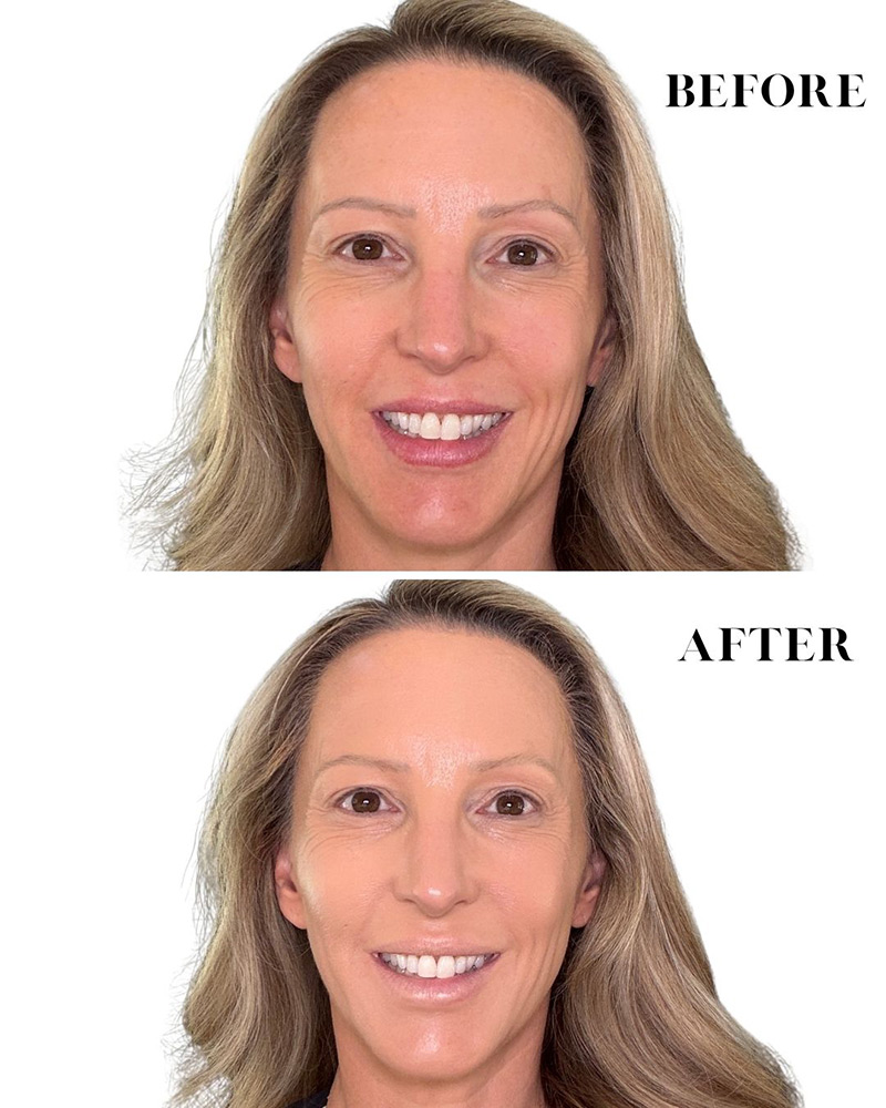 Haus Labs Triclone Skin Tech Foundation before and after results on white woman mid forties